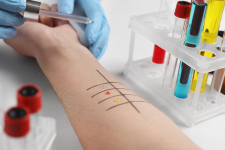 Doctor doing skin allergy test at light table, closeupの写真素材