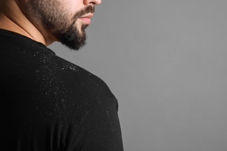 Man with dandruff on his sweater against gray background, closeup. Space for textの写真素材