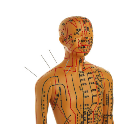 Acupuncture - alternative medicine. Human model with needles in shoulder isolated on whiteの写真素材