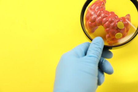 Endocrinologist looking at model of thyroid gland through magnifying glass on yellow background,...