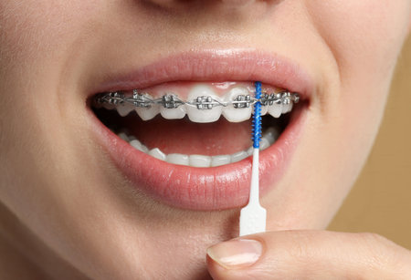 Woman with dental braces cleaning teeth using interdental brush, closeupの写真素材
