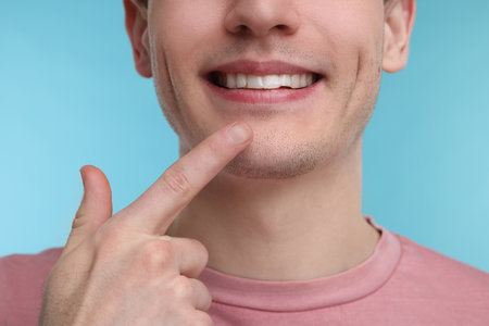 Young man showing his teeth with whitening strip on light blue background, closeupの写真素材