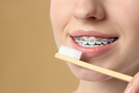 Woman with dental braces cleaning teeth on beige background, closeup. Space for textの写真素材