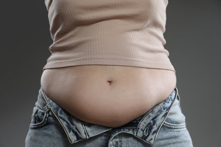 Woman with excessive belly fat on gray background, closeup. Overweight problemの写真素材