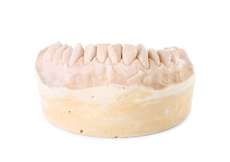 Dental model with jaw isolated on white. Cast of teeth