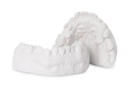 Dental model with gums isolated on white. Cast of teethの写真素材