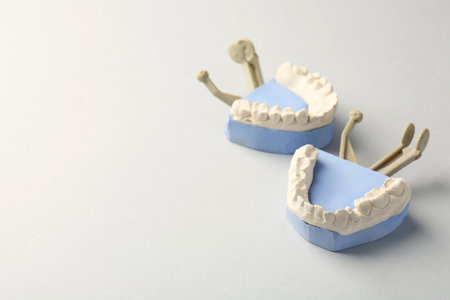 Dental model with gums on gray background, space for text. Cast of teethの写真素材