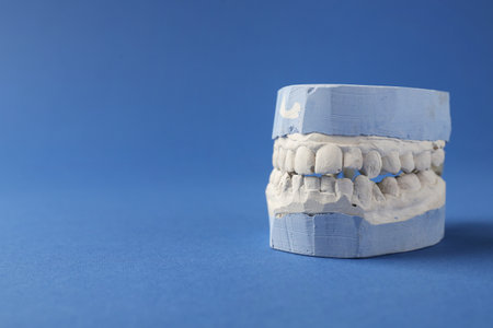 Dental model with gums on blue background, space for text. Cast of teethの写真素材