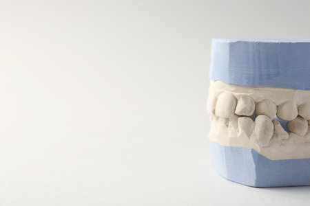 Dental model with gums on gray background, closeup and space for text. Cast of teethの写真素材