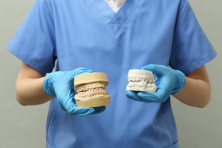 Doctor holding dental models with jaws on gray background, closeup. Cast of teethの写真素材