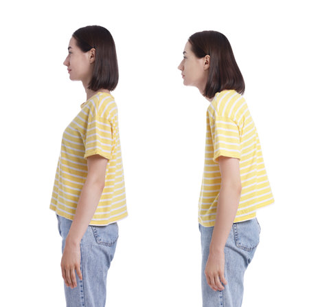 Woman with poor and good posture on white background, collage of photos