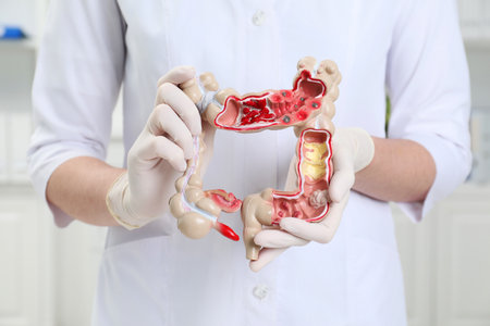 Doctor with model of large intestine in clinic, closeup