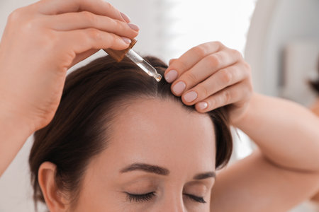 Hair loss problem. Woman applying serum onto hairline indoors, closeupの写真素材