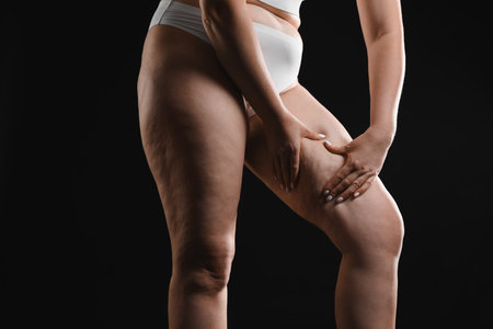 Woman with cellulite on black background, closeupの写真素材