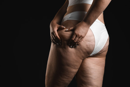 Woman with cellulite on black background, closeup. Space for textの写真素材