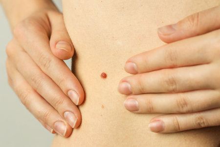 Woman with mole on her skin against light grey background, closeupの写真素材