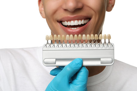 Doctor checking young man's teeth color on white background, closeup. Dental veneersの写真素材