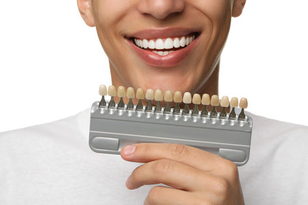 Happy young man with teeth color samples on white background, closeup. Dental veneersの写真素材