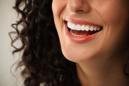Smiling woman on light grey background, closeup. Dental veneersの写真素材