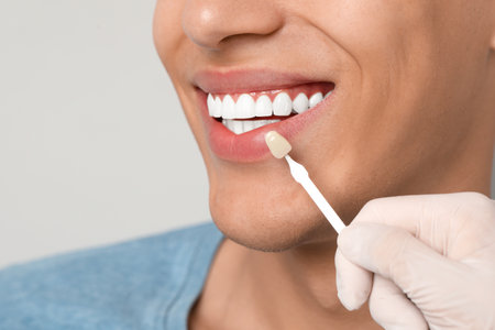 Doctor checking young man's teeth color on gray background, closeup. Dental veneersの写真素材