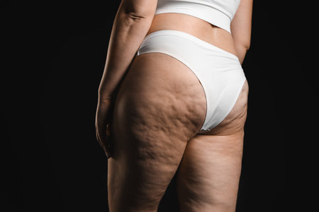 Woman with cellulite on black background, closeupの写真素材