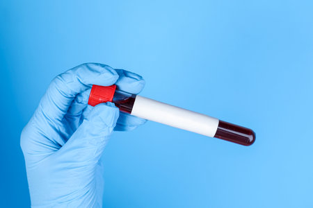 Laboratory worker holding test tube with blood sample and blank label on light blue background,...