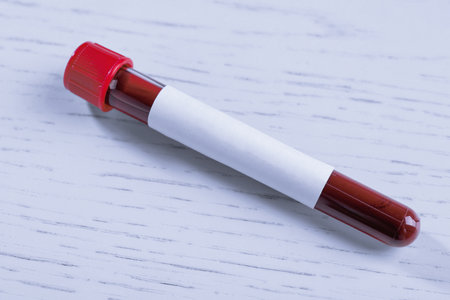 Blood in test tube with blank label on white wooden table, closeup. Laboratory analysisの写真素材
