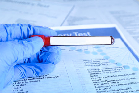 Laboratory worker holding test tube with blood sample and blank label over table, closeup. Medical analysisの写真素材