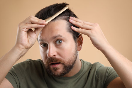 Man brushing his hair on beige background. Alopecia problemの写真素材