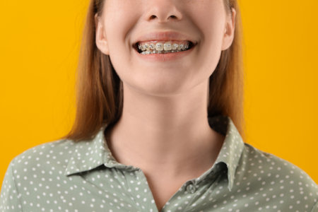 Girl with braces on orange background, closeupの写真素材