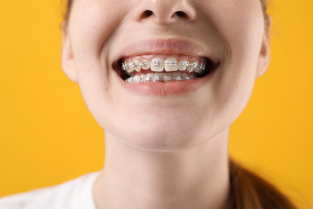 Girl with braces on background, closeupの写真素材