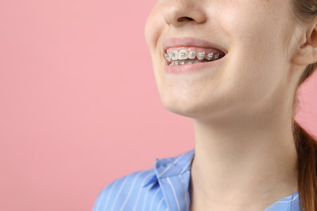 Girl with braces on pink background, closeup. Space for textの写真素材