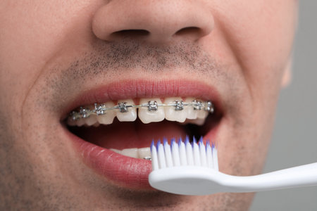 Man with dental braces cleaning teeth on gray background, closeupの写真素材
