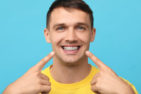 Smiling man pointing at his dental braces on light blue backgroundの写真素材