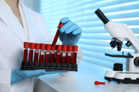 Laboratory testing. Doctor taking test tube with blood sample from rack indoors, closeupの写真素材
