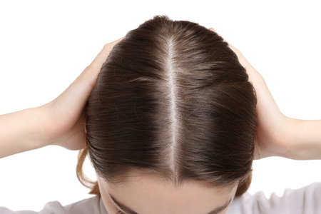 Girl with hair loss problem on white background, closeupの写真素材