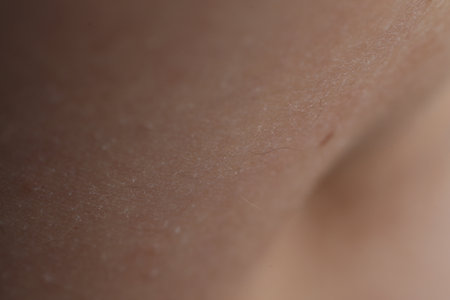 Texture of dry skin as background, closeupの写真素材