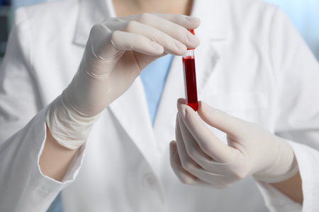Laboratory testing. Doctor holding test tube with blood sample indoors, closeupの写真素材
