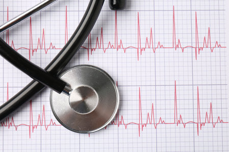 Cardiology. Stethoscope on paper with cardiogram, top view. Space for text