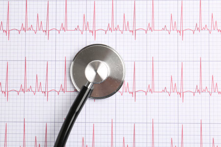 Cardiology. Stethoscope on paper with cardiogram, top view. Space for textの写真素材