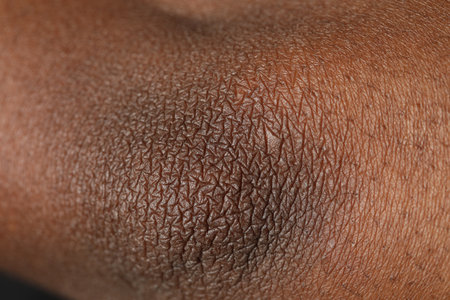 Macro view of normal skin as background