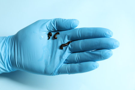 Doctor holding medicinal leeches on light blue background, closeupの写真素材