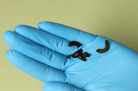 Doctor holding medicinal leeches on olive background, top view