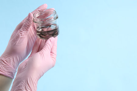 Woman holding glass jar with medicinal leeches on light blue background, closeup. Space for text