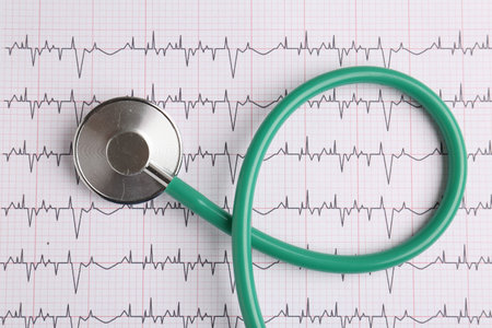 Cardiology. Stethoscope on paper with cardiogram, top viewの写真素材