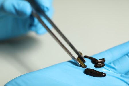 Doctor taking medicinal leech with tweezers on light grey background, closeupの写真素材