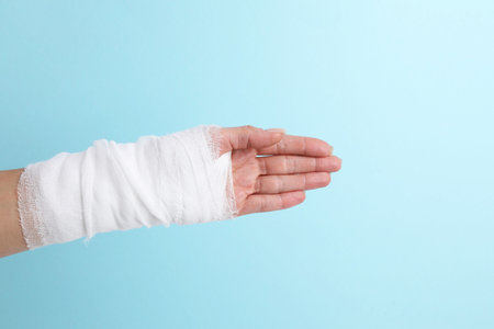 Woman with medical bandage on wrist against light blue background, closeupの写真素材