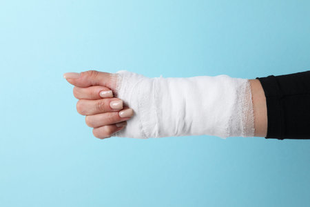 Woman with medical bandage on wrist against light blue background, closeupの写真素材