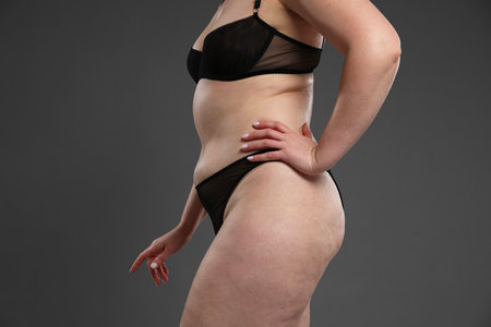 Woman with cellulite on dark grey background, closeupの写真素材