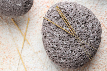 Acupuncture needles and spa stones on light textured table, flat layの写真素材